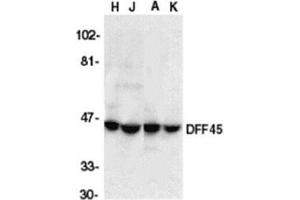 Western blot analysis of DFF45 in HeLa (H), Jurkat (J), A431 (A), and K562 (K) whole cell lysate with AP30289PU-N DFF45 antibody at 1/1000 dilution. (DFFA anticorps  (C-Term))