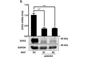 SOX2 mediates growth of bladder cancer cells. (SOX2 anticorps)
