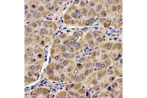 anti-Angiogenin (ANG) (N-Term) antibody