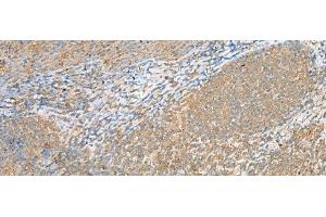 Immunohistochemistry of paraffin-embedded Human tonsil tissue using FOLR1 Polyclonal Antibody at dilution of 1:80(x200) (FOLR1 anticorps)