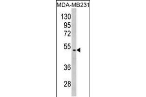 Western blot analysis of GALT Antibody in MDA-MB231 cell line lysates (35ug/lane)