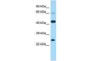 Host: Rabbit Target Name: CABS1 Sample Type: Fetal Heart lysates Antibody Dilution: 1. (CABS1 anticorps  (N-Term))