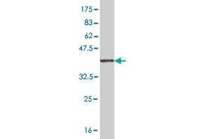 Western Blot detection against Immunogen (36. (RASGRP2 anticorps  (AA 65-164))