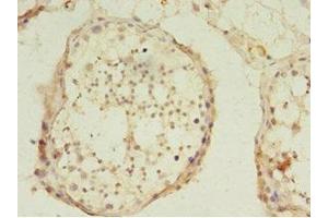 Immunohistochemistry of paraffin-embedded human testis tissue using ABIN7174332 at dilution of 1:100 (USP45 anticorps  (AA 1-240))