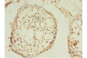 Immunohistochemistry of paraffin-embedded human testis tissue using ABIN7174332 at dilution of 1:100 (USP45 anticorps  (C-Term))