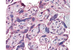 Anti-IFNAR2 antibody IHC of human placenta. (IFNAR2 anticorps  (AA 28-40))