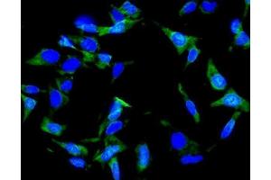 IF analysis of Inhibin alpha/INHA using anti-Inhibin alpha/INHA antibody (ABIN7600932).