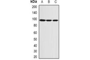 Western blot analysis of SBP-2 expression in MCF7 (A), Hela (B), mouse thymus (C) whole cell lysates. (SECISBP2 anticorps)