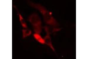 ABIN6275264 staining Hela cells by IF/ICC. (MYH15 anticorps  (Internal Region))