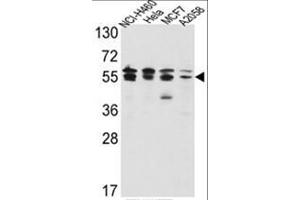 Western blot analysis of IMPDH2 Antibody (Center) in NCI-H460,Hela,MCF7,A2058 cell line lysates(35ug/lane). (IMPDH2 anticorps  (Middle Region))
