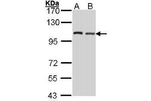 WB Image Sample (30 ug of whole cell lysate) A: Hela B: Hep G2 , 7. (EIF4G2 anticorps  (C-Term))