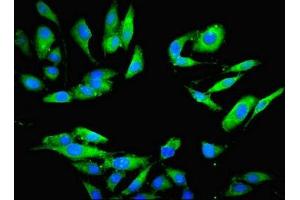 Immunofluorescent analysis of Hela cells using ABIN7164964 at dilution of 1:100 and Alexa Fluor 488-congugated AffiniPure Goat Anti-Rabbit IgG(H+L)