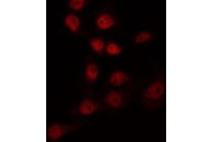 ABIN6266966 staining COS7 by IF/ICC. (FOXL1 anticorps)