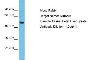 Host: Rabbit Target Name: SHISA9 Sample Type: Fetal Liver lysates Antibody Dilution: 1. (Shisa9 anticorps  (Middle Region))