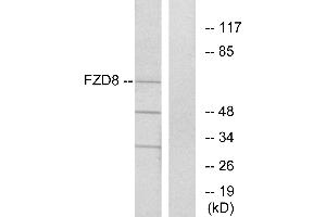 Western blot analysis of extracts from Jurkat cells, using FZD8 antibody. (FZD8 anticorps  (Internal Region))
