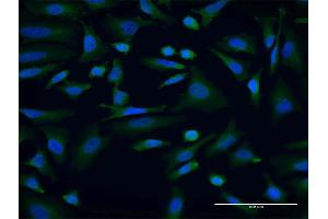 Immunofluorescence of monoclonal antibody to AKAP9 on HeLa cell.