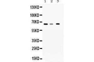 Western blot analysis of WDR1 expression in rat liver extract ( Lane 1), mouse brain extract ( Lane 2) and A431 whole cell lysates ( Lane 3). (WDR1 anticorps  (C-Term))