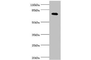 Western blot All lanes: KCND2 antibody at 0.