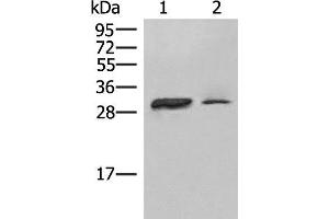 Western blot analysis of Raji cell Human spleen tissue lysates using HLA-DPA1 Polyclonal Antibody at dilution of 1:400 (HLA-DPA1 anticorps)