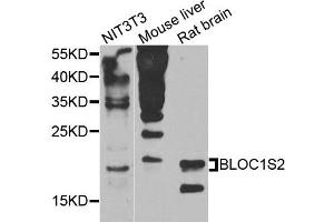 Western blot analysis of extracts of various cells, using BLOC1S2 antibody. (BLOC1S2 anticorps)