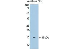 Detection of Recombinant Haptoglobin, Human using Polyclonal Antibody to Haptoglobin (Hpt)