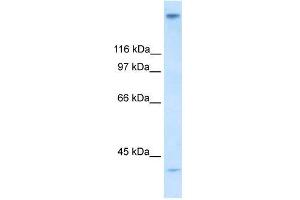 Human Stomach; WB Suggested Anti-ZNF318 Antibody Titration: 0. (ZNF318 anticorps  (N-Term))