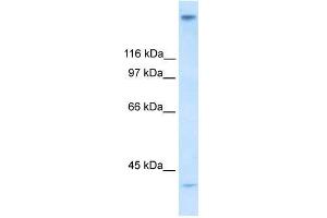 Human Stomach; WB Suggested Anti-ZNF318 Antibody Titration: 0. (ZNF318 anticorps  (N-Term))