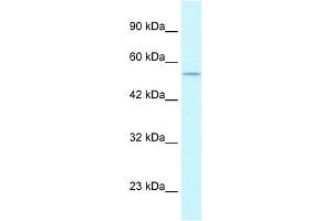 WB Suggested Anti-EGLN1 Antibody Titration:  1. (EGLN1 anticorps  (C-Term))
