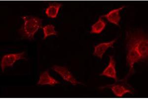 ABIN6272369 staining NIH-3T3 by IF/ICC. (OR13C8 anticorps)