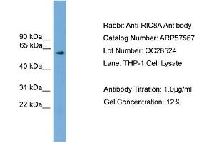 WB Suggested Anti-RIC8A  Antibody Titration: 0. (RIC8A anticorps  (N-Term))