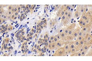 Detection of CASP8 in Human Liver Tissue using Polyclonal Antibody to Caspase 8 (CASP8)