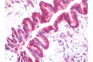 Anti-GSTT1 antibody IHC staining of human lung. (GSTT1 anticorps  (AA 1-240))