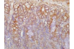 Formalin-fixed and paraffin embedded rat intestine labeled with Rabbit Anti-c-Kit Polyclonal Antibody, Unconjugated  at 1:200 followed by conjugation to the secondary antibody and DAB staining