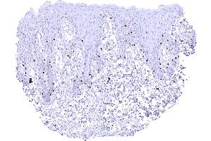 Scattered SOX10 positive melanocytes in the epidermis of the skin (Recombinant SOX10 anticorps)
