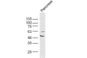 Mouse pancreas lysates probed with AKT1/3 Polyclonal Antibody, unconjugated  at 1:300 overnight at 4°C followed by a conjugated secondary antibody at 1:10000 for 90 minutes at 37°C. (AKT1/3 (AA 401-479) anticorps)