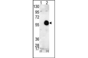 Western blot analysis of AKT2 (arrow) using AKT2 Antibody (AKT2 anticorps  (C-Term))