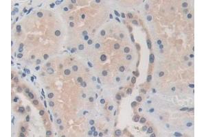 Detection of MMP19 in Human Kidney Tissue using Polyclonal Antibody to Matrix Metalloproteinase 19 (MMP19)