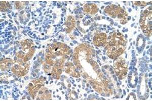 Immunohistochemical staining (Formalin-fixed paraffin-embedded sections) of human kidney with FAH polyclonal antibody  at 4-8 ug/mL working concentration. (FAH anticorps  (C-Term))