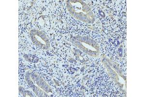 IHC analysis of RPL23 using anti-RPL23 antibody (ABIN7599808).