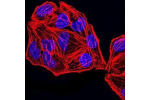 Immunofluorescence analysis of Hela cells using MSH2 mouse mAb.