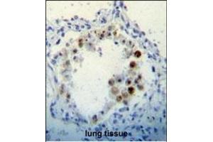 CDKN2B Antibody (C-term) (ABIN656561 and ABIN2845822) immunohistochemistry analysis in formalin fixed and paraffin embedded human lung tissue followed by peroxidase conjugation of the secondary antibody and DAB staining.