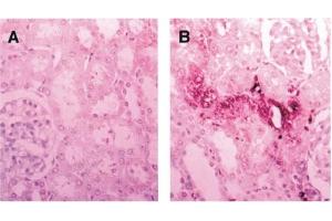 Immunohistochemistry image of CRA-modified protein staining in paraffn sections of rat kidney exposed to ferric nitrilotriacetate. (Crotonaldehyde (CRA) anticorps)