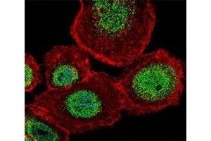 Fluorescent confocal image of A431 cell stained with LEF1 antibody at 1:25.