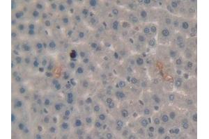 Detection of Plg in Rat Liver Tissue using Polyclonal Antibody to Plasminogen (Plg)