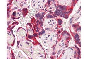 Anti-IDS antibody IHC of human placenta. (IDS anticorps  (AA 440-451))