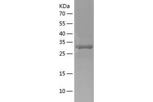 Western Blotting (WB) image for Wolf-Hirschhorn Syndrome Candidate 1-Like 1 (WHSC1L1) (AA 1021-1322) protein (His-IF2DI Tag) (ABIN7125740)