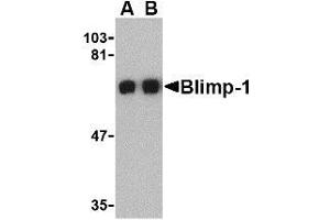 Western blot analysis of Blimp-1 in A549 cell lysate with AP30154PU-N Blimp-1 antibody at (A) 0. (PRDM1 anticorps  (C-Term))