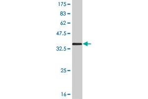 Western Blot detection against Immunogen (32. (SIX3 anticorps  (AA 273-332))