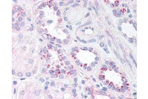 affinity purified anti-p65 (RelA) pS536 antibody was used at 5.