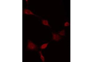ABIN6275281 staining HT29 by IF/ICC. (MT-ND5 anticorps  (Internal Region))